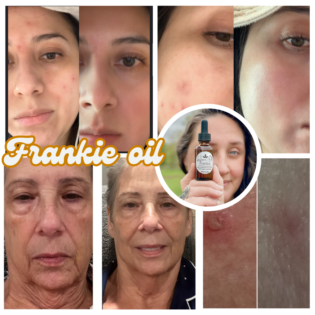 Frankie 4oz