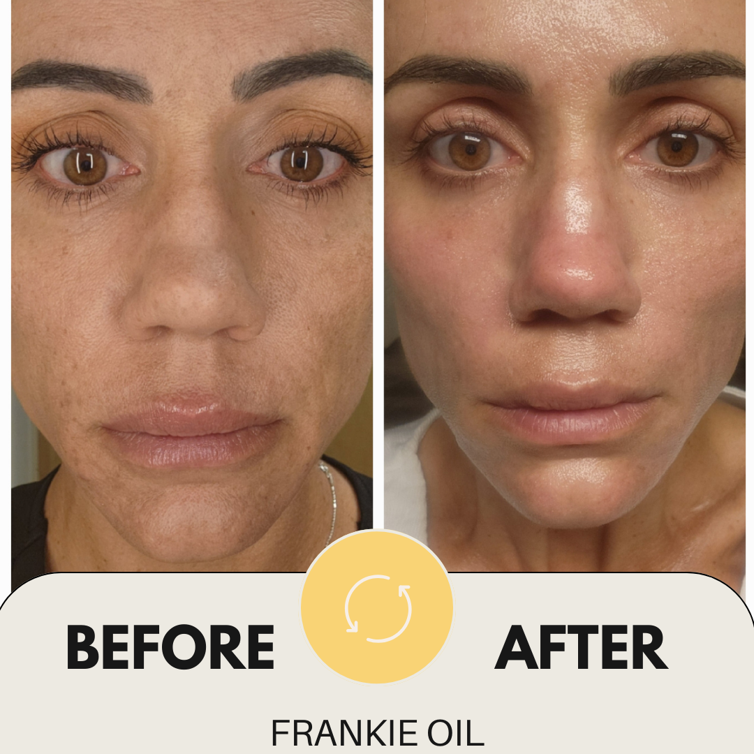 Frankie 1oz